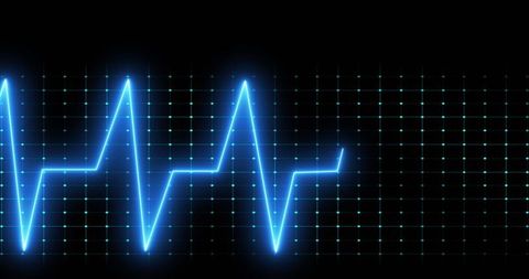 Digital Cardiograph Display with Bright Blue Pulses - Download Free Stock Images Pikwizard.com