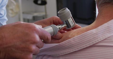 Doctor Examining Skin of Senior Patient with Dermatology Device
