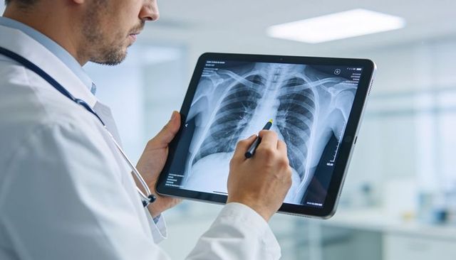 Doctor annotating chest x-ray on tablet, digital radiology review in clinic