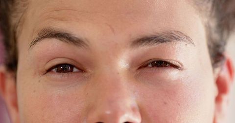 Focused facial close-up highlighting skin texture and freckles
