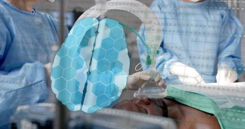 Anesthetist holding oxygen mask over patient with digital brain overlay in operating room