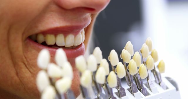 Close-up of dentist holding teeth shades against female patients mouth in dental clinic 4k