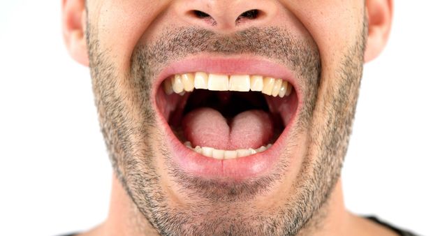 Close-up of Person Yawning with Mouth Wide Open - Download Free Stock Images Pikwizard.com