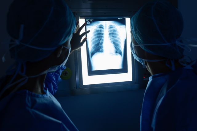 Surgeons in blue scrubs and surgical masks are analyzing a chest x-ray in an operating room. This image can be used in medical articles, healthcare websites, educational materials, and hospital brochures to illustrate teamwork, diagnosis, and patient care in a surgical setting.