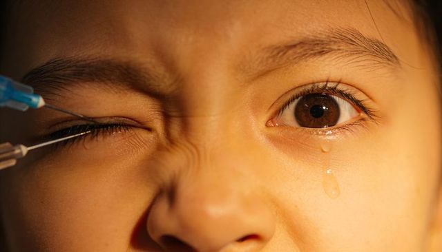 Wincing asian child receiving ophthalmic injection with syringe and teardrop closeup clinical distre