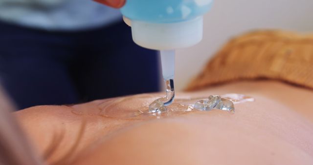 Close-up view of hands applying massage oil on patient's back, ideal for wellness spa promotions, massage therapy services, and skin care product demonstrations. Great for highlighting relaxation and therapeutic services offered at spas and wellness centers.