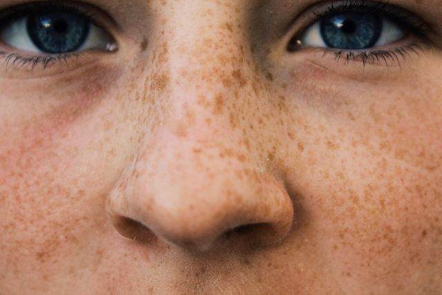 Close-up image highlighting freckles and striking blue eyes, emphasizing facial features, skin texture and natural beauty. Suitable for use in dermatology, skincare, beauty products, and campaigns focused on individuality and uniqueness.