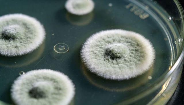 Fuzzy fungal colonies growing on agar plate macro, mold culture on petri dish