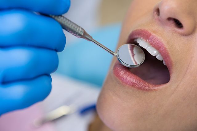 Close-up view of a dentist using an angled mirror to examine a patient's teeth. Ideal for use in articles, blogs, and promotional materials related to dental care, oral health, and medical clinics. Can also be used in educational content about dental hygiene and professional dental services.