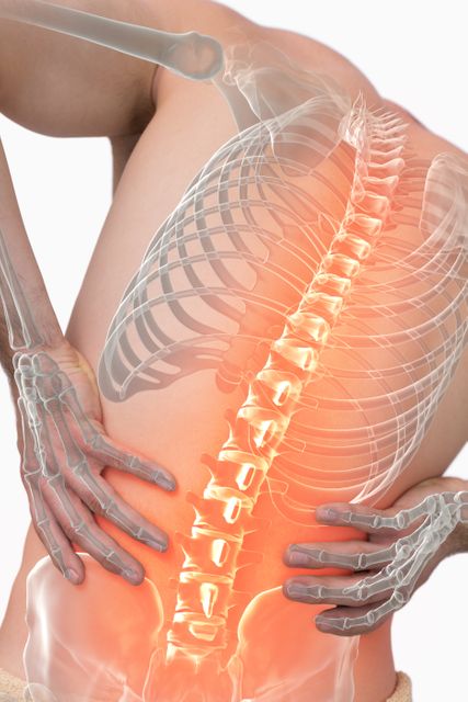 This digital composite image features a man experiencing back pain, with the spine highlighted to indicate discomfort. The exposed skeletal structure emphasizes anatomy and pain localization in the lower back. This image is suitable for use in medical or health publications, educational materials, or promotional content relating to back pain, chiropractic care, and spinal health treatments.