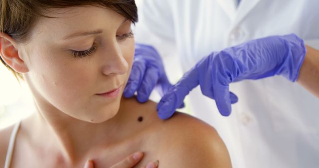 A healthcare professional is examining a mole on the shoulder of a young Caucasian woman, with copy space. Regular skin checks are crucial for early detection of skin conditions and maintaining dermatological health.