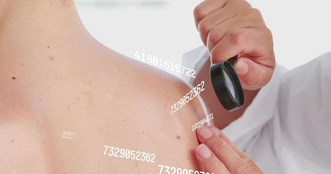 Dermatologist examining shoulder mole with magnifying lens and ar data overlay