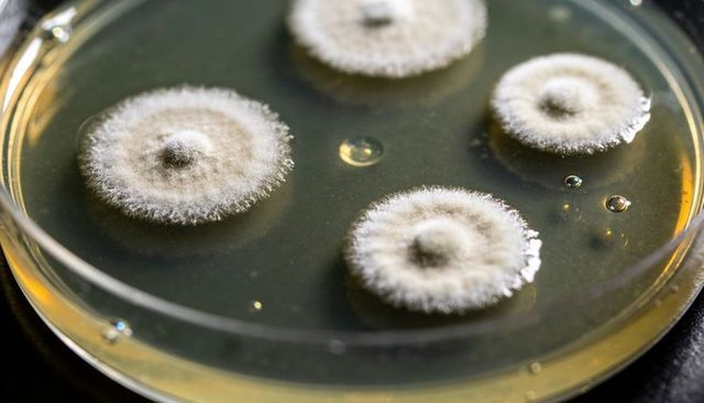 Fuzzy Mold Colonies Growing on Yellow Agar in Petri Dish Macro Lab Culture