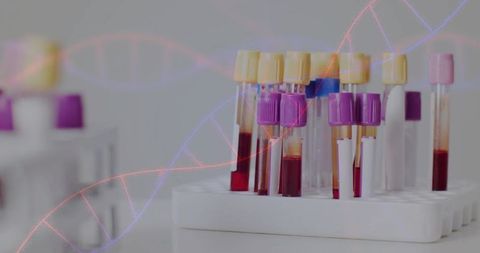 Blood collection tubes sitting in rack with dna strand overlay for laboratory testing