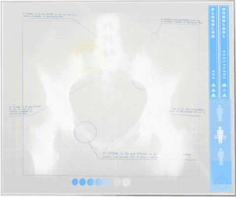 transparent x-ray of human pelvis on digital interface - Download Free Stock Videos Pikwizard.com