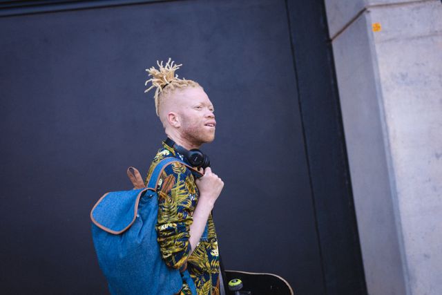 This image depicts an albino young man walking on the street with a skateboard, wearing a patterned shirt, backpack, and headphones. His dreadlocks and casual attire reflect a modern, urban lifestyle. This image can be used for articles or campaigns focusing on albinism awareness, youth culture, street fashion, or lifestyle blogs.