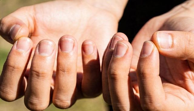 Offering open palms closeup showing fingernails sunlit adult hands outdoors minimal detail