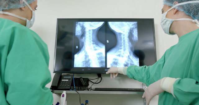 Healthcare professionals dressed in green scrubs and surgical masks study spinal X-ray results on a computer screen in a medical facility. Useful for topics related to medical analysis, healthcare, doctor activities, spinal health, and medical technology.