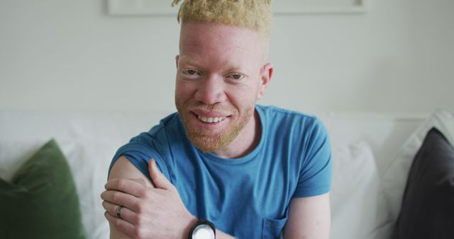 Portrait of Smiling Albino Man in Blue T-Shirt at Home - Download Free Stock Images Pikwizard.com