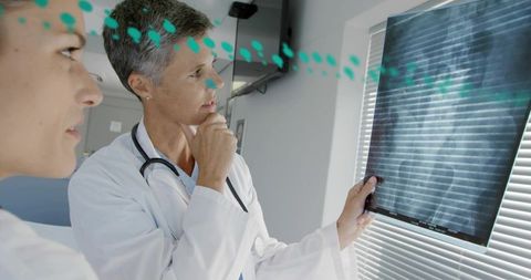 Senior physician reviewing chest x-ray film with colleague during clinical consultation