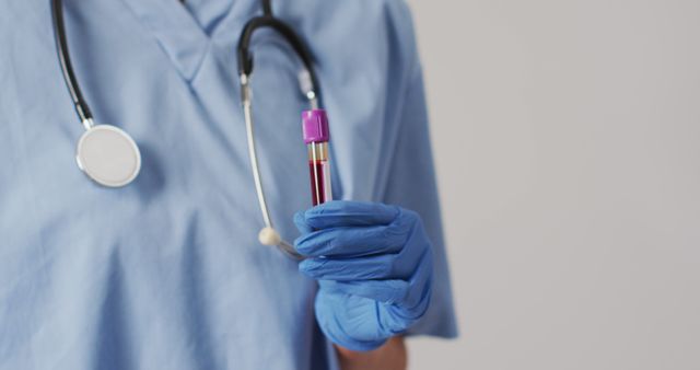 Healthcare Professional Holding Blood Sample With Gloved Hand - Download Free Stock Images Pikwizard.com