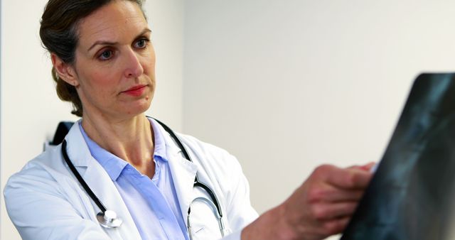 Female Doctor Reviewing X-Ray Image in Hospital - Download Free Stock Images Pikwizard.com