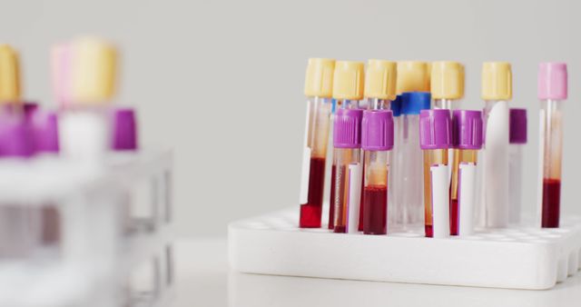 Vibrant blood test tubes organized in laboratory settings, useful for medical research and healthcare-related articles or presentations. Perfect for illustrating topics on diagnostics, scientific discoveries, medical examinations, and laboratory equipment visuals.