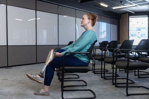 Woman showing prosthetic leg in modern office waiting area
