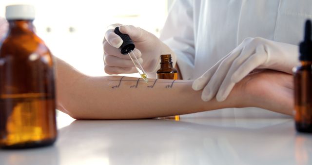 A healthcare professional is performing a skin allergy test on a patient's arm, with copy space. The procedure involves applying potential allergens to the skin to identify reactions, indicating allergies.