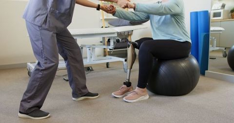 Physical Therapist Aiding Woman with Prosthetic Leg in Balance Exercise