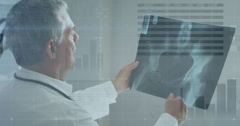 Doctor Examining X-ray with Digital Financial Overlay - Download Free Stock Images Pikwizard.com