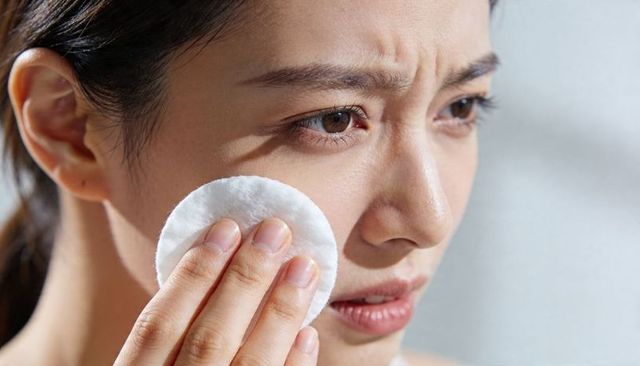 Closeup portrait asian woman cleansing face with cotton pad during gentle skincare routine