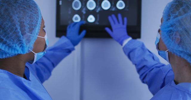 Two medical professionals wearing blue scrubs, surgical caps, and gloves analyzing brain scans on a monitor. Ideal for use in medical articles, health care websites and educational materials highlighting medical technology, diagnostic procedures, and workforce collaboration.