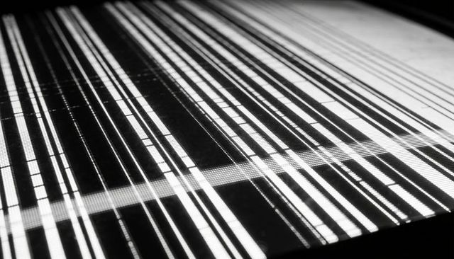 Monochrome electronic display showing vertical pixel striping and digital glitch pattern