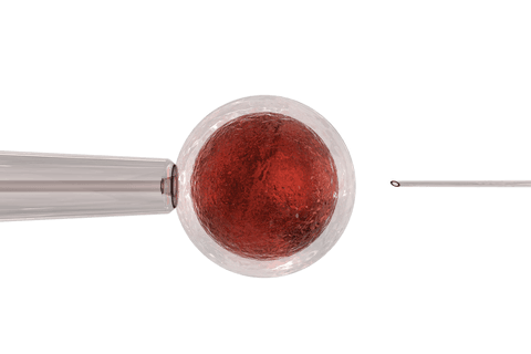 transparent intracytoplasmic sperm injection process - Download Free Stock Videos Pikwizard.com
