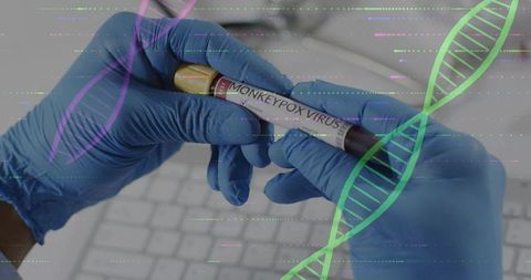 Gloved hands holding monkeypox virus blood sample tube on keyboard with dna overlay