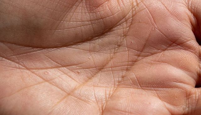 Macro palm texture showing fine creases, ridges and dry skin flakes under warm light